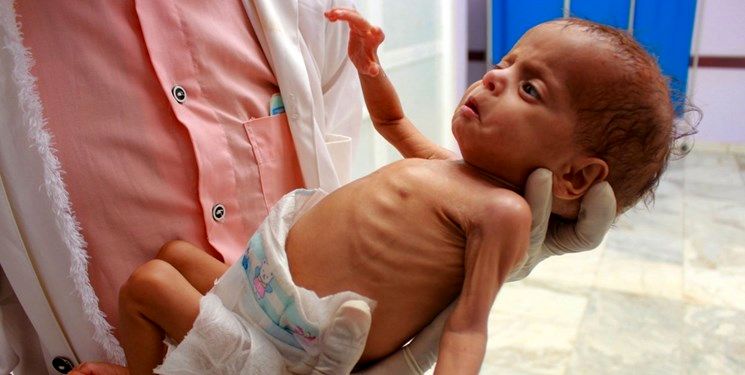فوت سالانه ۱۰۰ هزار نوزاد در یمن به دلیل محاصره و جنگ