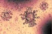 ثبت نخستین موارد ابتلا به ویروس کرونا در شماری از کشور‌های سراسر جهان
