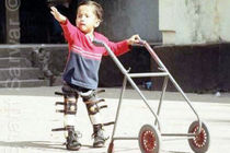 ارائه خدمات رایگان توانبخشی به کودکان دارای معلولیت
