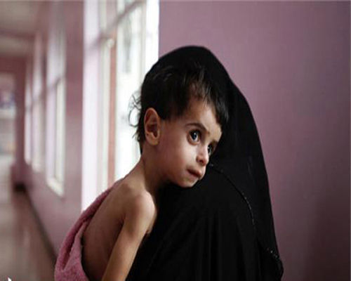 شناسایی 962 کودک دچار سوءتغذیه در مناطق محروم گیلان