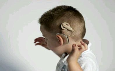 علوم پزشکی کرمانشاه مجوز جراحی کاشت حلزون شنوایی را به دست آورد