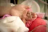 نجات معجزه‌آسای نوزاد ۲۷ هفته‌ای در شریعتی؛ ترخیص پس از سه ماه تلاش تیم تخصصی