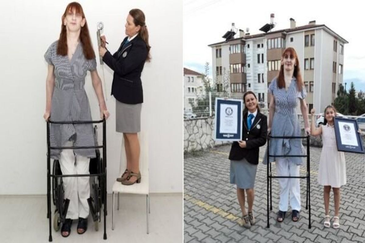 بلندقدترین زن جهان در ترکیه سه رکورد گینس را شکست