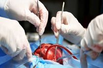 انجام موفقیت آمیز یکی از پیچیده‌ترین جراحی‌های قلب در شیراز