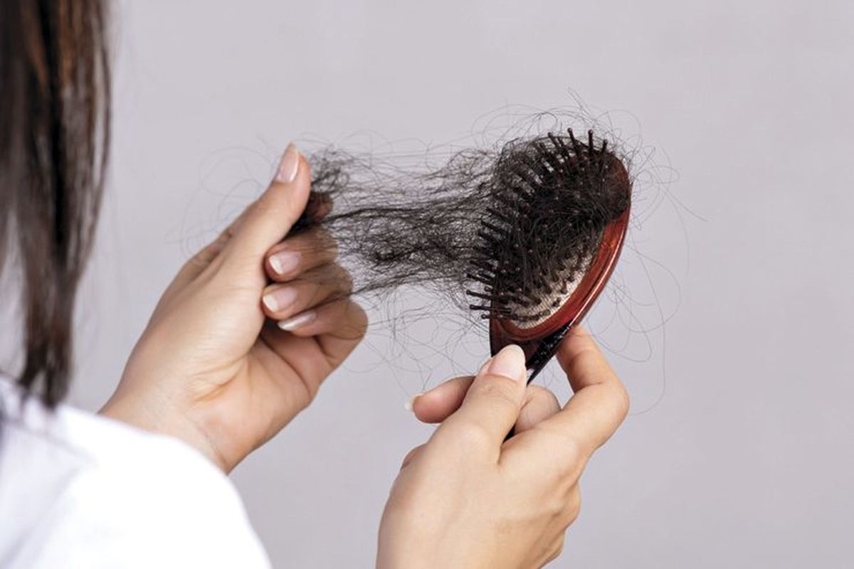 روش‌های آسان برای کمک به کاهش ریزش مو/ دور غذاهای چرب را خط بکشید 