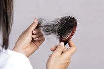 دلایل ریزش مو/ راهکارهای موثر در درمان ریزش مو