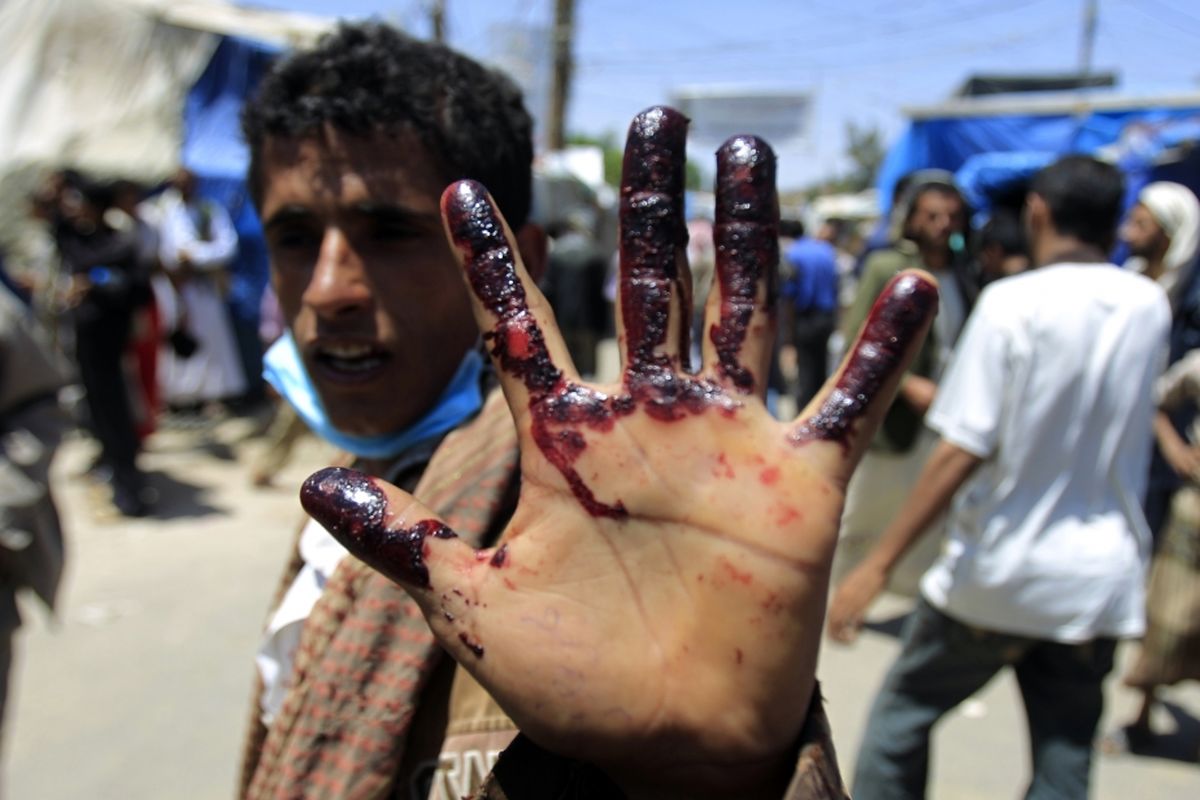 بزرگترین بحران انسانی جهان در یمن است