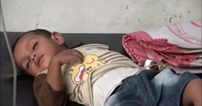 تشدید نگرانی ها از شیوع "تب دنگی" در یمن