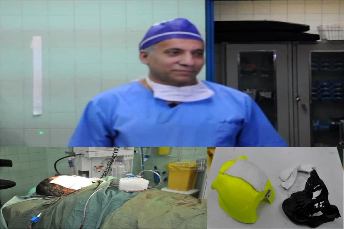 انجام عمل جراحی نادر ترمیم جمجمه با مواد اولیه استخوانی در مرکز آموزشی درمانی الزهرا اصفهان