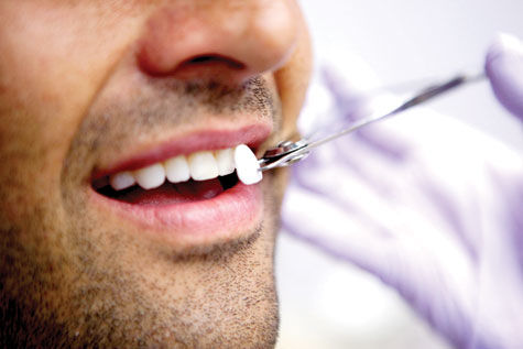 استفاده از سرامیک های دندانی، راهی برای ترمیم پوسیدگی