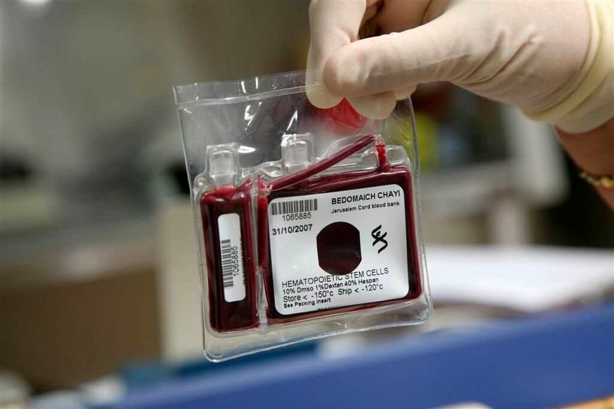 افزایش ۲۵ درصدی ذخیره خون بند ناف نوزاد در هرمزگان