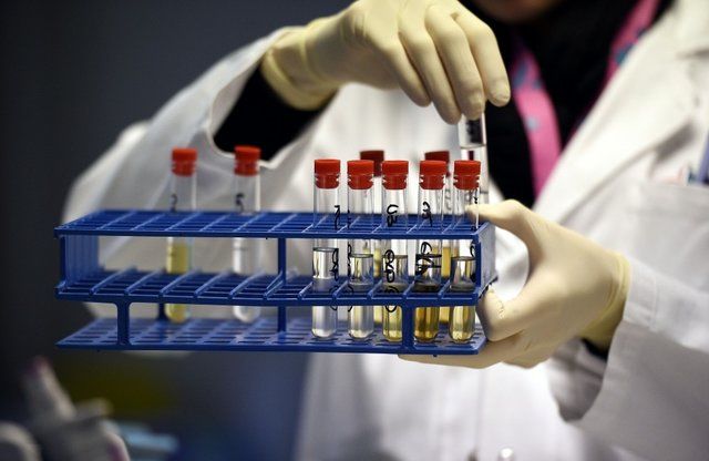 آزمایشگاه ضد دوپینگ پاریس تعلیق می شود