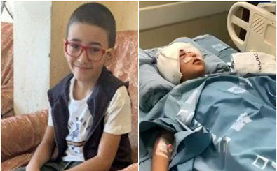 کودک فلسطینی با شلیک نظامیان صهیونیست، نابینا شد